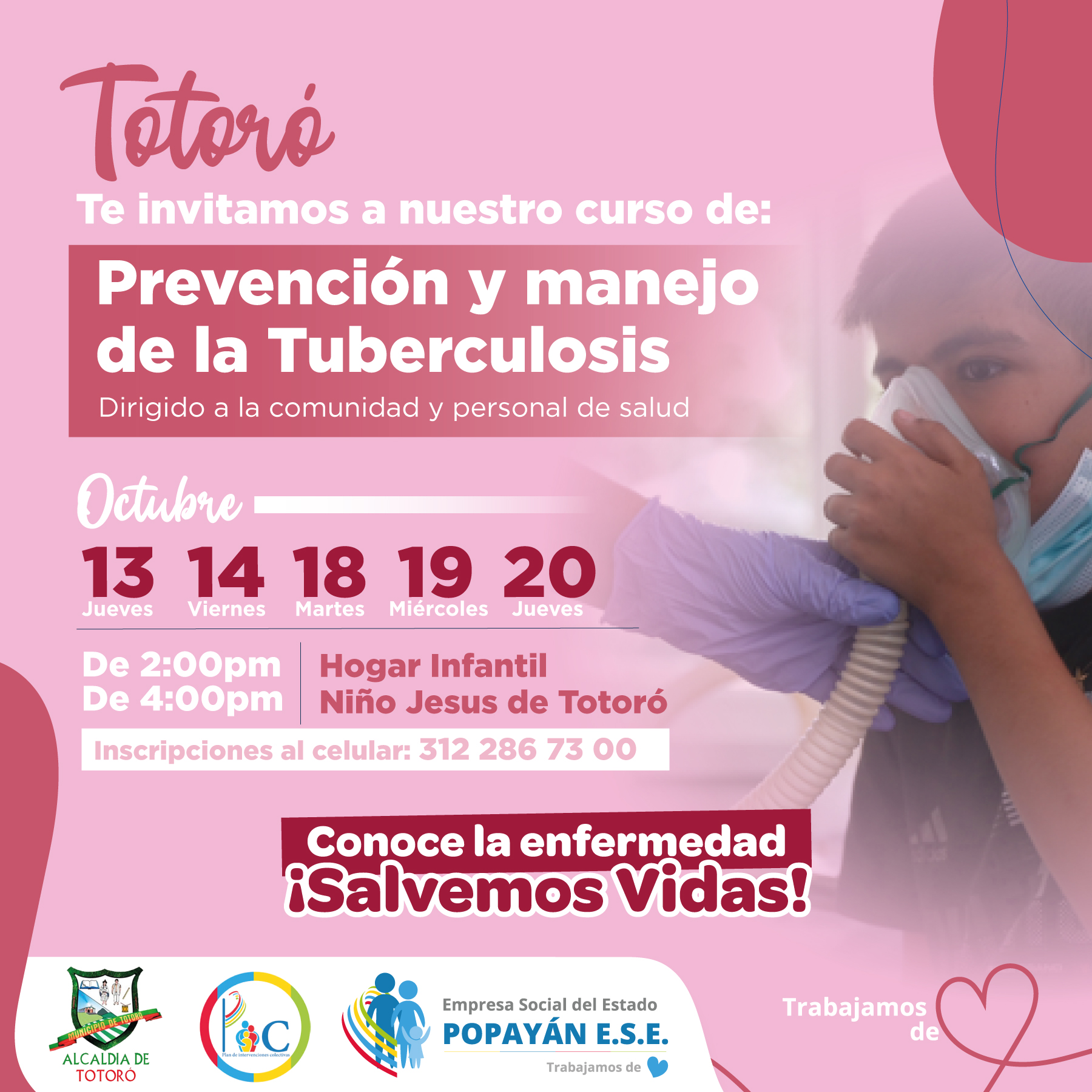 TUBERCULOSIS